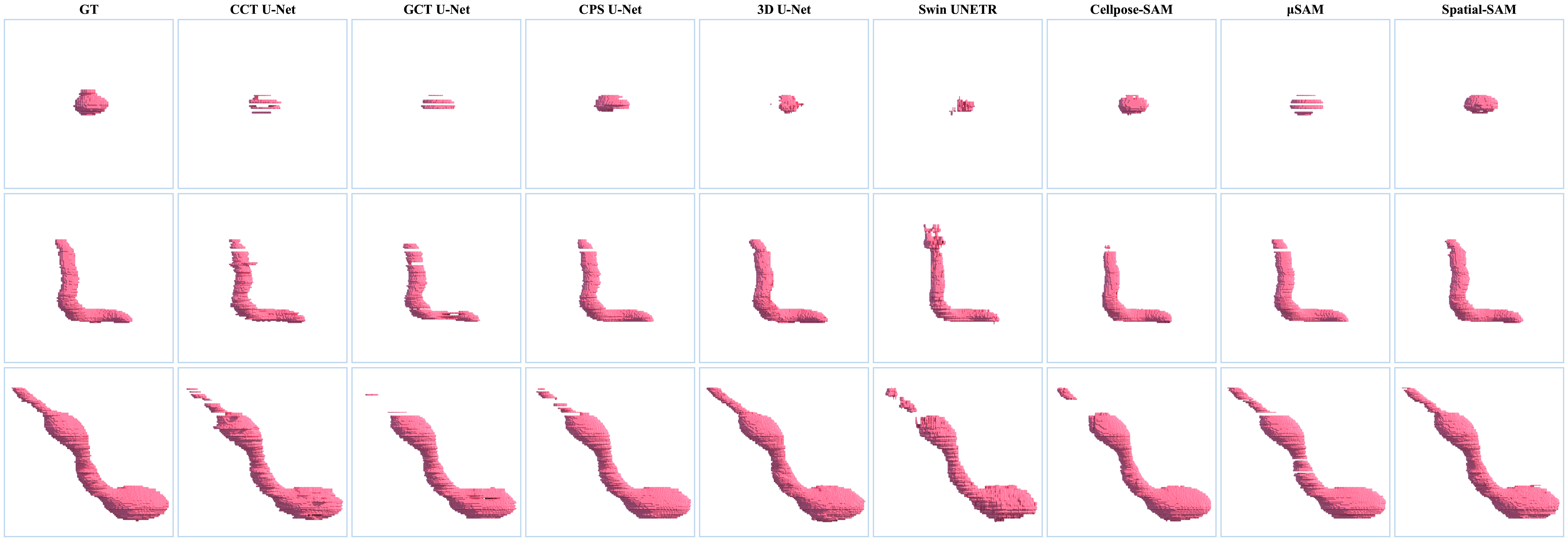 3D visualization comparison of different methods on mitochondria