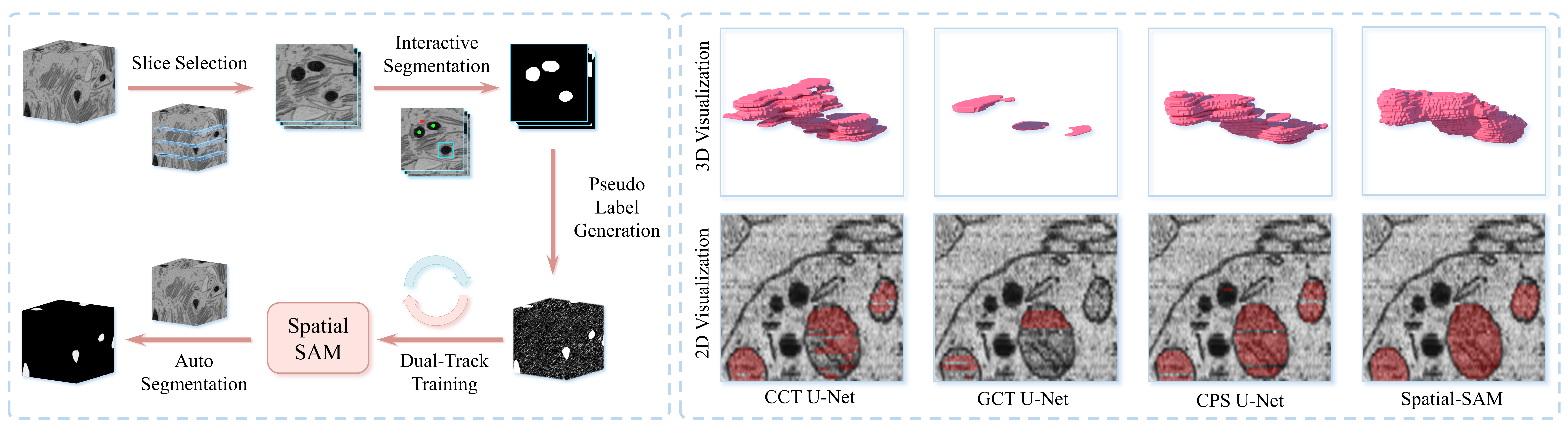 Spatial-SAM teaser figure showing the workflow and qualitative comparison