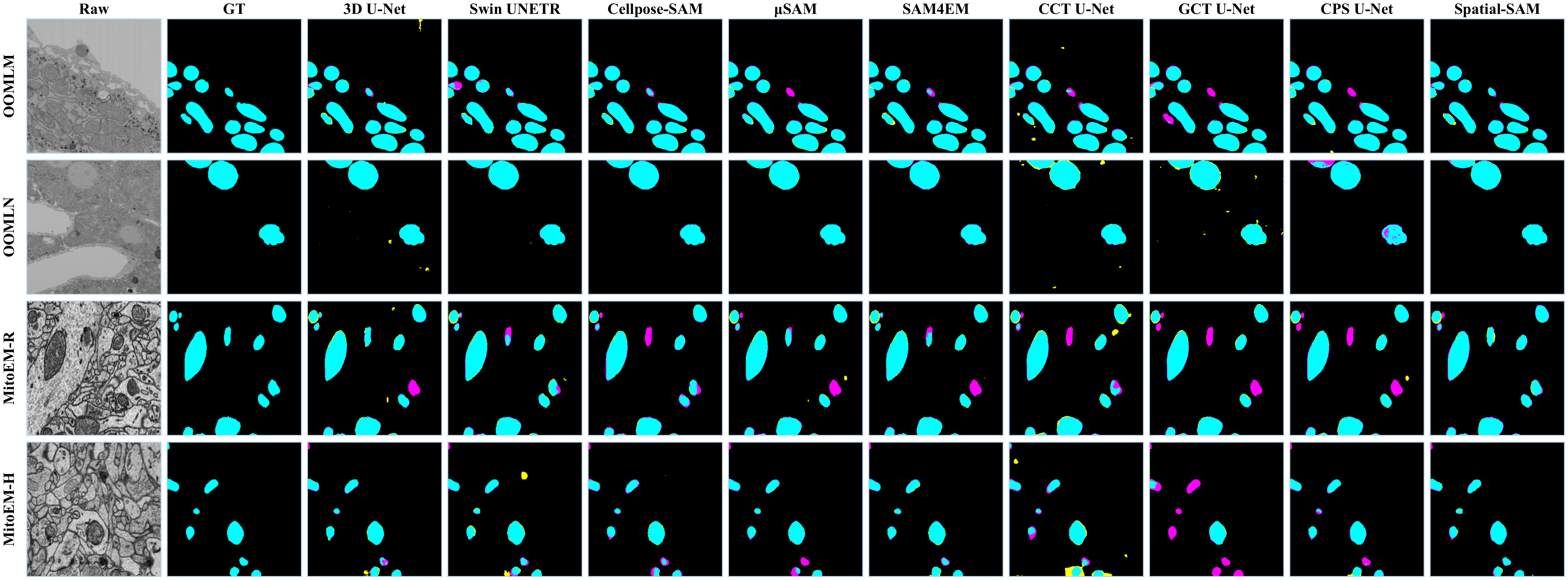 Visualization of segmentation results on OpenOrganelle and MitoEM datasets