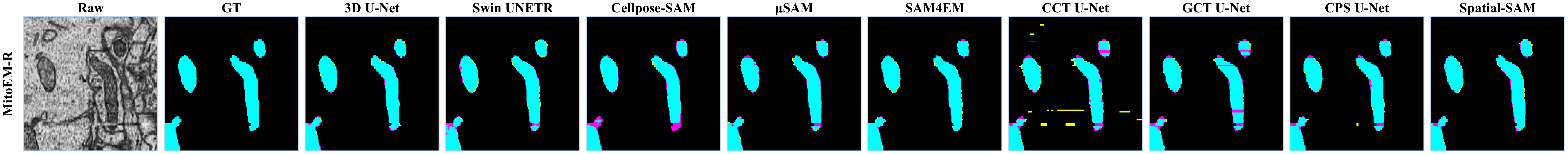 Visualization of segmentation results of MitoEM-R on x-z plane